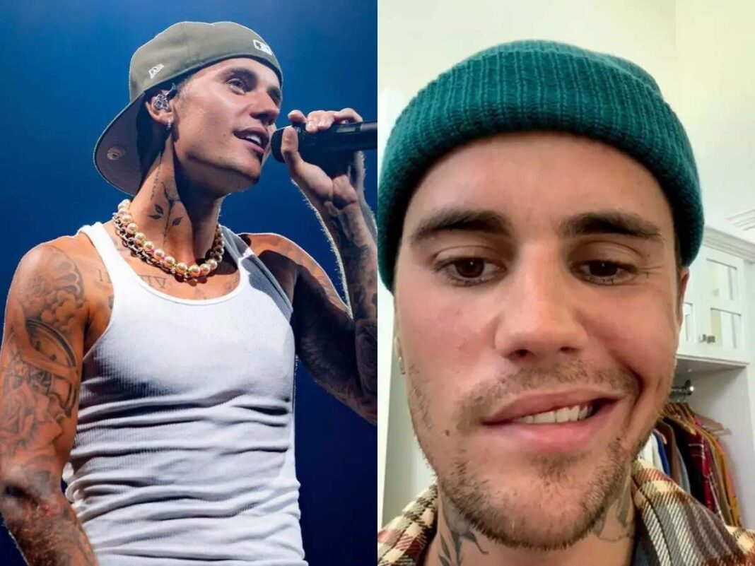 Justin Bieber Suffers From Facial Paralysis