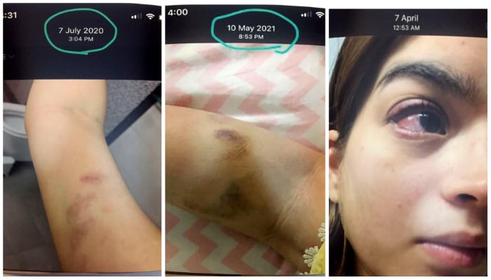 Alizay shown the images of domestic violence